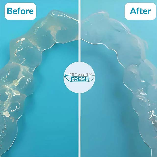 Denture Cleaning Tablets – 4 Month Supply (120 Tablets) by Retainer Fresh Cleanser | Ultimate Denture & Retainer Care